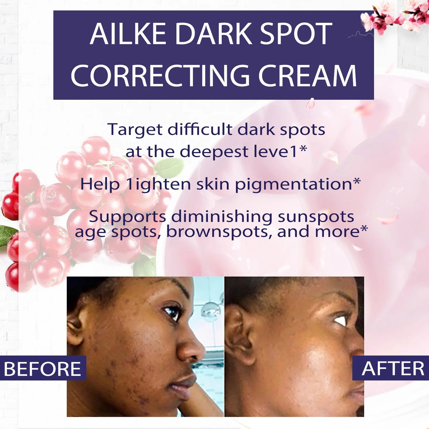 AILKE Dark Spots Remover Cream