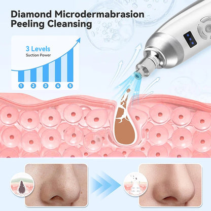 Portable Diamond Microdermabrasion Machine for Blackhead Removal