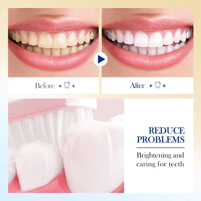 Probiotic Brightening Toothpaste Deep Cleaning Teeth Gap Tooth Yellow Corrector Fresh Breath Whitening Toothpaste 220g