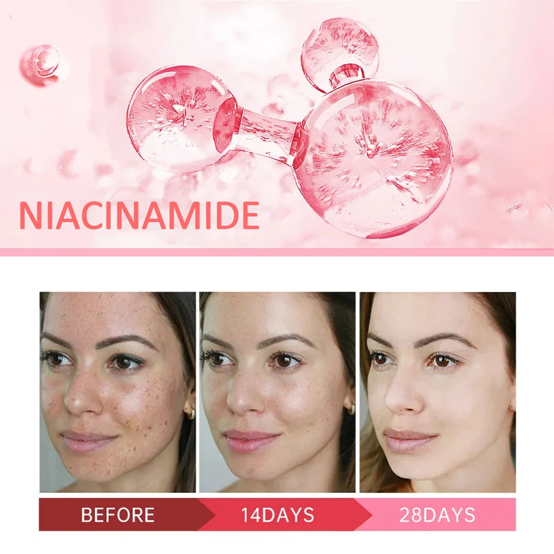 Niacinamide Dark Spot Remover Serum for Face Whitening Moisturizer Hyaluronic Acid Removal Freckle Facial Serum Skin Care