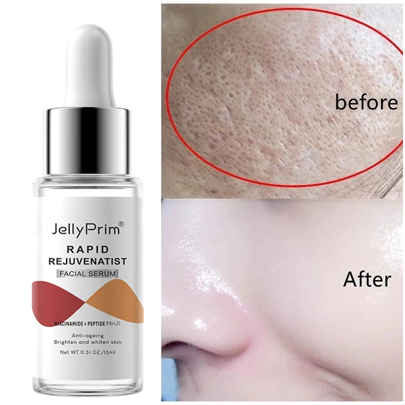 Niacinamide Dark Spot Remover Serum for Face Whitening Moisturizer Hyaluronic Acid Removal Freckle Facial Serum Skin Care