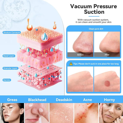 Portable Diamond Microdermabrasion Machine for Blackhead Removal